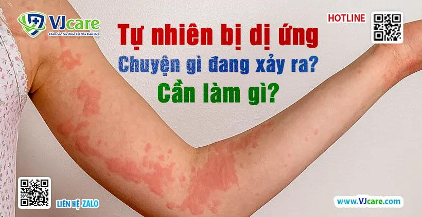Tự nhiên bị dị ứng - Chuyện gì đang xảy ra? Cần làm gì? 1 Tự nhiên bị dị ứng - Chuyện gì đang xảy ra? Cần làm gì?